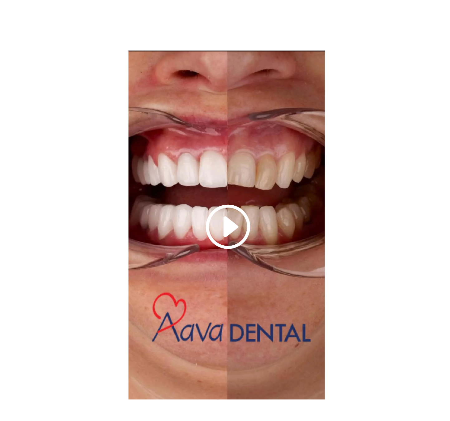 화면 캡처 2024-12-14 184253.png